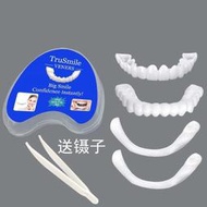 假牙丨牙 吃飯牙 護牙 仿真牙齒模型 臨時牙貼
