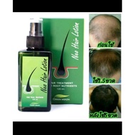 100% ORIGNAL NEO HAIR LOTION SPRAY