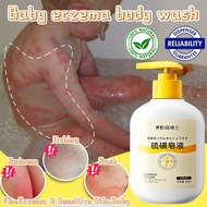Baby Eczema Body Wash Baby Antibacterial Body Wash 300ml Baby Eczema Wash Skin Repair Antibacterial 