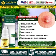 Obat Untuk Bisul Oles Bisul Di Pantat Bisul Bernanah Bisul Di Kemaluan Bisul Di Kaki Dan Tangan Bisu