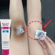 Kojic Acid ครีมขาหนีบดำ 50ml ครีมทาขาหนีบดำ ครีมทารักแร้ขาว ปรับสีผิวให้กระจ่างใส เลือนเมลานิน ขาหนี