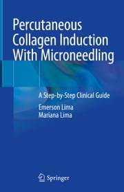 Percutaneous Collagen Induction With Microneedling Emerson Lima