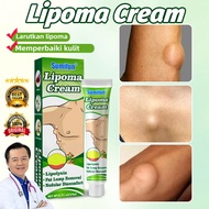 Lipoma Cream Lipoma Removal Cream Fat Health Care Cream Lipoma Subcutaneous Herbal Lipoma Removal Oi