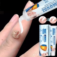 Wart Remover Ointment 20g ketuat remover Warts removal cream Kutil removal Ubat buang ketuat tahi la