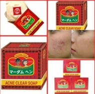 Madame Heng Acne Clear Soap สบู่ มาดามเฮง แพ็คละ 3ก้อน