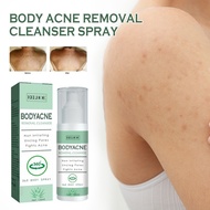 Back Acne Repair Spray Acne Mark Removal Pimple Scar Anti Itching Redness Oil Control Shrink Pores S
