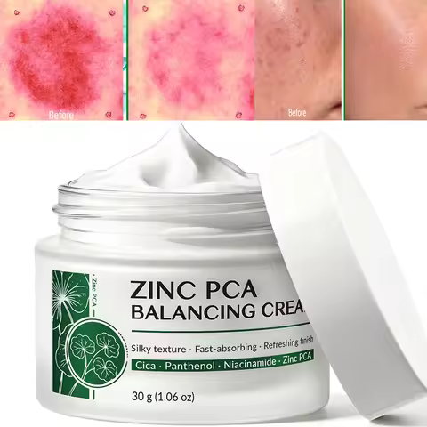 Zinc PCA Blemish Relief Cream, Face Moisturizer For Acne-Prone Skin, Lightweight, Breakouts, Barrier