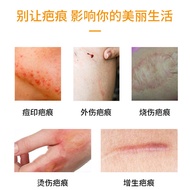 Scar Cream 0gPUVIDA Postoperative Scar Repair Growth Scar FDA People Certification GMP