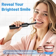 Electric Dental Teeth Polisher Dental Scaler eléctrico Plaque Remover Tartar Teeth Whitening Kits10 