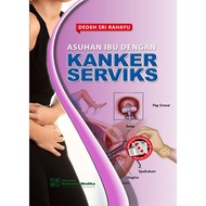 Mother's Care with Cervical Cancer by Dedeh Sri Rahayu