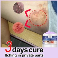 Skin antipruritic cream psoriasis eczema treatment cream antifungal cream skin itching cream psorias