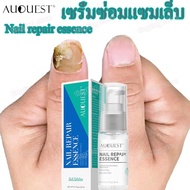 AuQuest เซรั่มทาเล็บ เชื้อราเล็บมือ 20ml ยาทาเชื้อราที่เล็บ ทาเล็บ น้ำยาทาเล็บ น้ำมันทาเล็บ ทาเชื้อร