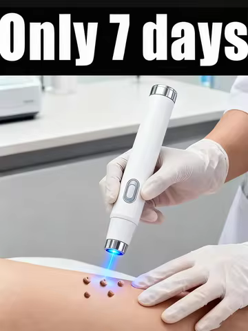 Skin Care Blue Tool Warts Blue Light Tool, Easy To Clean Skin Care Tool
