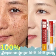 Whitening Freckle Cream 15g Penghilangkan Bintik Gelap Anti Bintik Niacinamide Memudar Pigmentasi Me