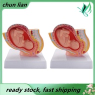 [ lian]2X Human Pregnancy Fetal Development 9Th Month Embryonic Pelvic Model Fetus Foetus Pregnancy 