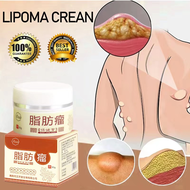 lipoma Lipoma Ointment lipoma removal cream Subcutaneous fat fiber natural herbal essence effectivel