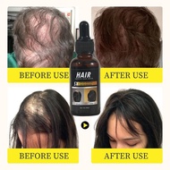 Hair Growth Serum Hair Serum,Concentration Enhancement Hair Serum, Hair Growth Oil 30ml