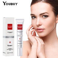 Youbuy Blemish Cream Whitening Blemish Freckles Rejuvenating Moisturizing Blemish Removal Cream Face