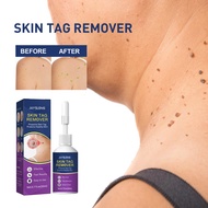 Jaysuing Jaysuing Smooth Skin Cleansing Keyou External Use Gentle Nourishing Body Skin Care Agent