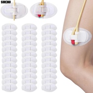 SIRENU Catheter Fixation Sticker, Adhesive Breathable Urinary Tube Holders, Portable Disposable Cath