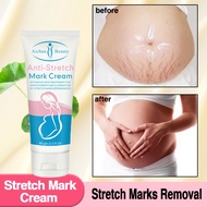 STRETCH MARK CREAM Postpartum Stretch Mark Cream REMOVER STRETCH MARK CREAM STRETCH MARKS 60g REMOVE