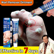 warts remover original watson warts removal kasoy oil warts remover legit greatlife warts remover sk