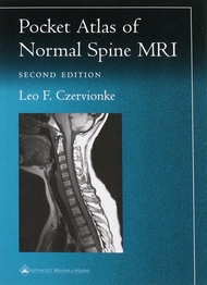 Pocket Atlas of Spinal MRI (Radiology Pocket Atlas Series) Pocket Atlas of Spinal MRI (Radiology Poc