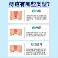 Thailand Hemorrhoid cream DOPROCT Original imported internal泰国痔疮膏DOPROCT原装进口内外痔消肉球缓解瘙痒疼痛痔疮膏4.25.2