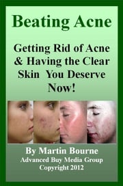 Beating Acne: Getting Rid of Acne &amp; Having the Skin You Deserve Now! Advanced Buy Media Group