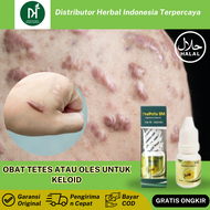 Obat Keloid, Obat keloid daging tumbuh, Penghilang keloid daging tumbuh, keloid telinga PROPOLIS SM