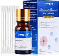 Fast-Acting 17% Salicylic Acid Wart & Mole Remover Liquid for Feet - Maximum Strength Plantar Wart C