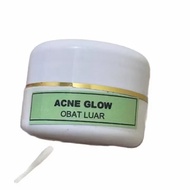 Cream Malam Wajah Acne Glow Label Hijau