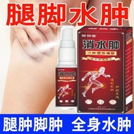 9.7-1 [Old Brand Swelling Relieving Pain Spray Sedentary Sitting Legs Foot Edema Reduction Spray Eld