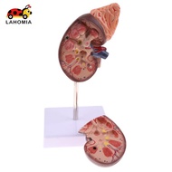 LAHOMIA Lifesize 1:1 Human Removable Kidney Adrenal Gland Model W/Base Lab Equipment