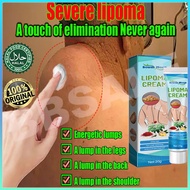 Lipoma Cream Benjolan Ubat Benjolan Lipoma Removal Cream Removal Multiple Single Lipoma Subcutaneous