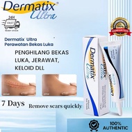 【Genuine Hot】Dermatix Ultra Scar Gel - 15g|CPX Silicone Technology + Vitamin C Ester|Lighten Dark Sc
