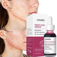 FRUIT ACID SERUM acne serum miss v glad2glow peeling serum  peeling serum glad2glow pore serum face 