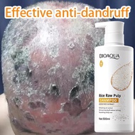 Anti Dandruff Shampoo Psoriasis shampoo Scalp shampoo 500ml scalp treatment itchy scalp shampoo