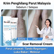 Krim Regangan Penyingkiran Lama Krim Penghilang Parut Menghilangkan Tanda Caesar Melecur Melecur Par