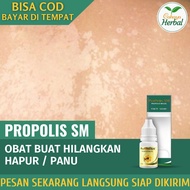 Propolis SM Brazil Obat Untuk Hapuran - Obat Penghilang Hapur Kulit - Obat Salep Hapuran Kulit - Pan