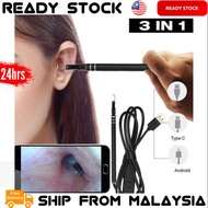 Digital Led Otoscope Ear Camera Scope Earwax Removal Kit Ear Wax Cleaning Tool Endoscopic