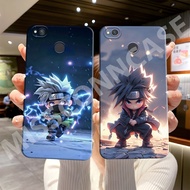 Softcase hp Redmi 4X - 6 - 6A - 7A - 4A - 5A - Note 5A - Note 5A Prime - Note 5 - Note 5 Pro Casing 