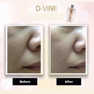 Dvine D Vine Permen Collagen Terbaik 100% Original | Dvine 20 Butir