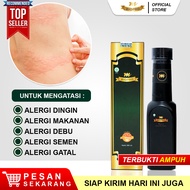 Obat Alergi Paling Ampuh Alergi Kulit Gatal Bentol Alergi Dingin Alergi Makanan Alergi Debu Alergi S