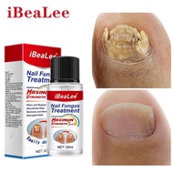 IBEALEE NAIL FUNGUS TREATMENT RAWATAN KULAT KUKU BAIKI KUKU ROSAK NIPIS PECAH penghapus kulat kuku c