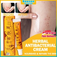 ⭐️SG STOCK⭐️ Huatuobaifuling Chinese Traditional Herbal Cream Itch Eczema Ringworm Psoriasis Antifun