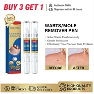[READY STOCK]EELHOE Warts Remover Pen Mole Remover Pen Skin Tag Remover Pen Skin Care Repair Liquid 