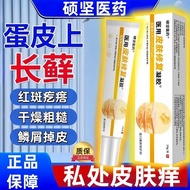 Ready stock Long-Term Egg Skin Itchy Private Parts Skin Itchy Egg Skin Itchy Red Swelling Wet Itchy 