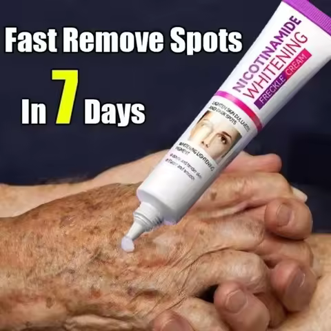 Mild Niacinamide Lightening Melasma Cream Effectively Fade Melanin Bleaching Cream Remove Dark Pigme