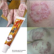 Chinese oriental medicine dermatological cream reduces itching, eczema, ringworm, psoriasis, keratos